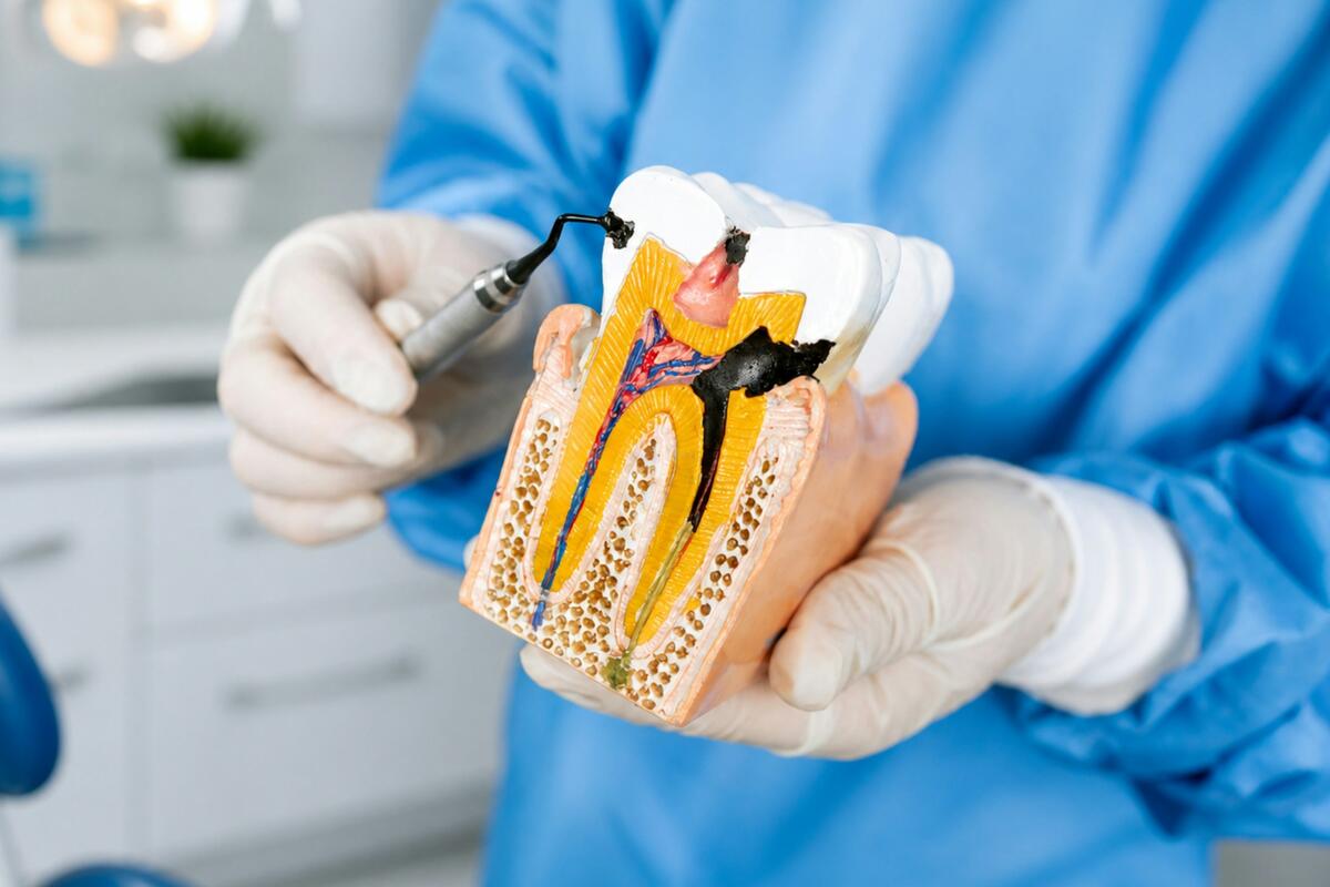 Gloved hands pointing a probe at a cavity on a cut-away model of a tooth
